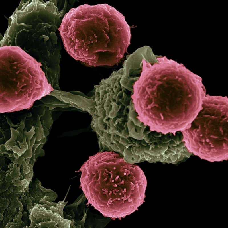 Immune cells under an electron microscope